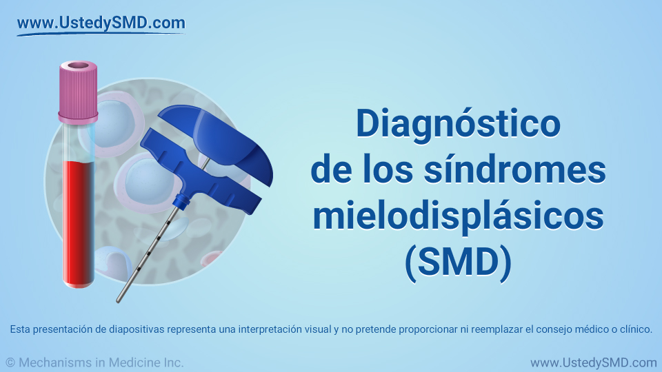 Diagnóstico de los síndromes mielodisplásicos (SMD)