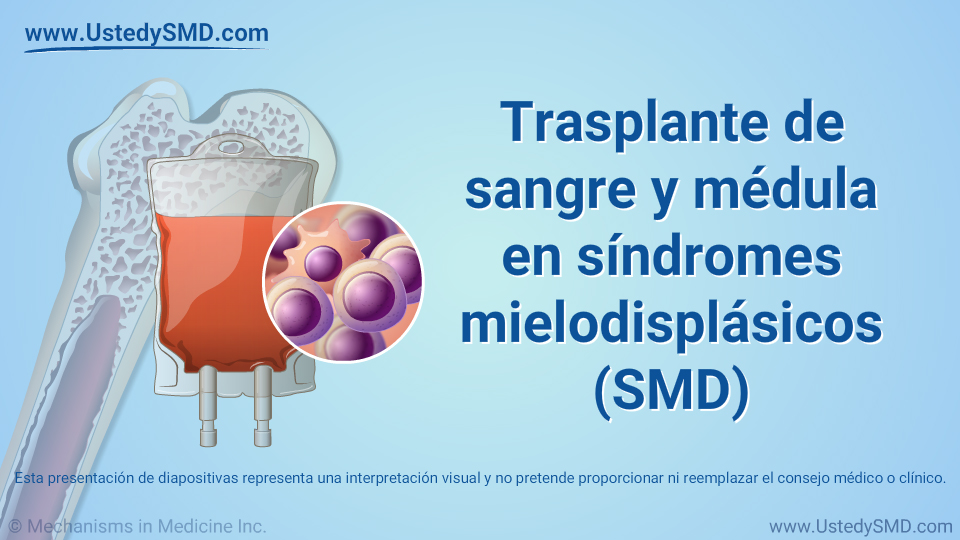 Trasplante de sangre y médula en síndromes mielodisplásicos (SMD)
