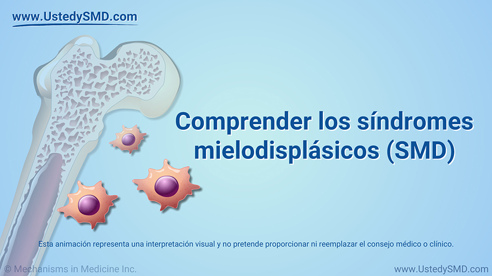 Comprender los síndromes mielodisplásicos