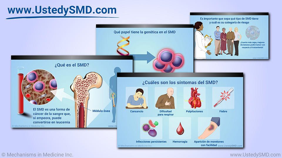 Presentación de diapositivas - Comprender los síndromes mielodisplásicos