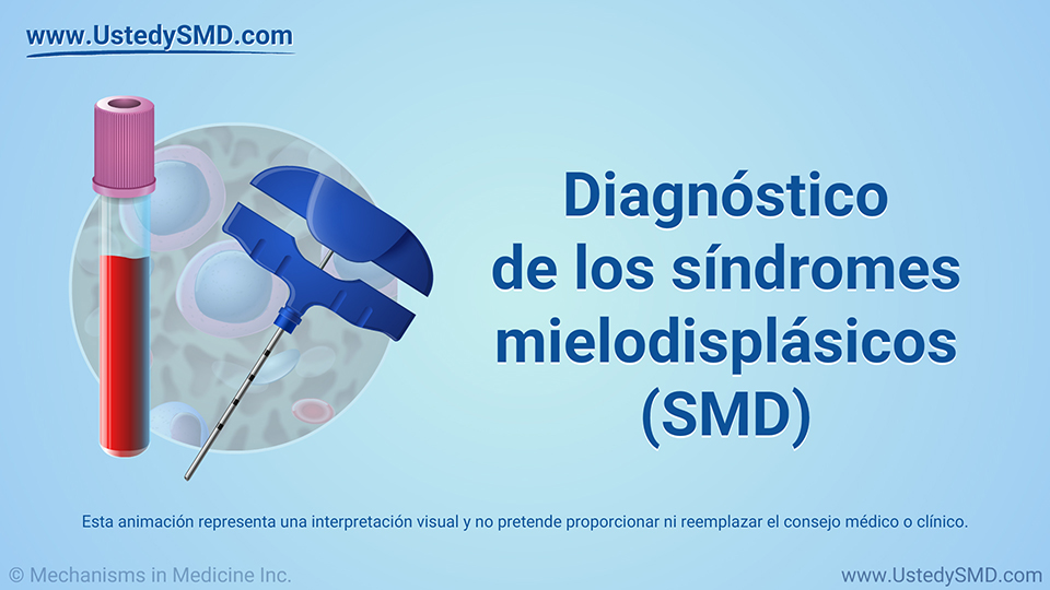 Diagnóstico de los síndromes mielodisplásicos (SMD)