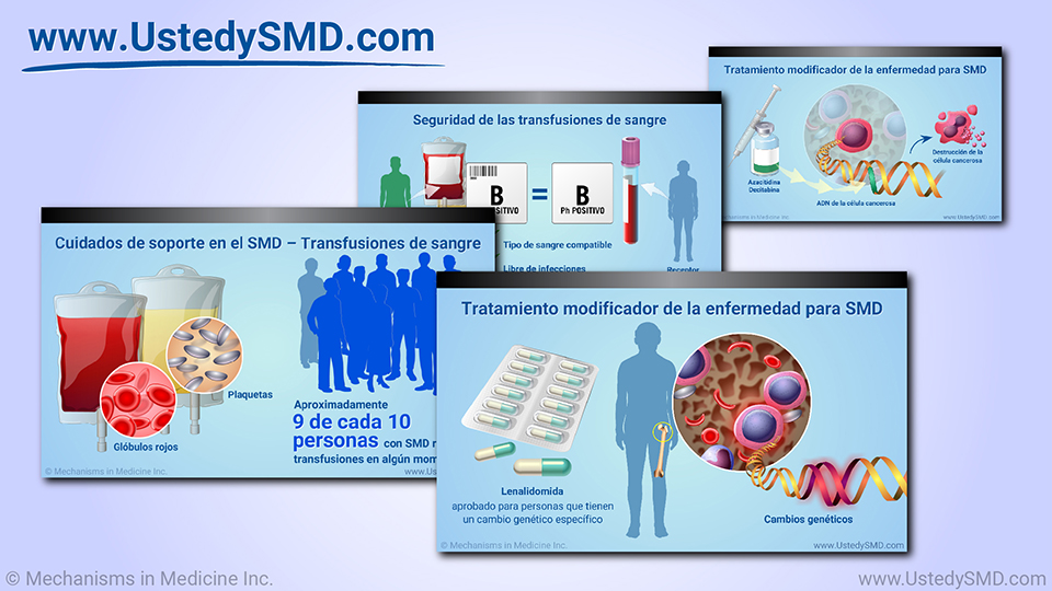 Manejo y tratamiento de SMD