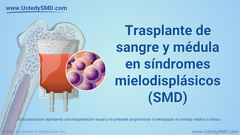 Trasplante de sangre y médula en SMD