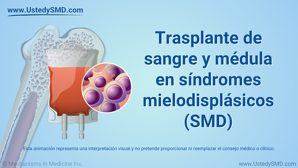 Trasplante de sangre y médula en síndromes mielodisplásicos (SMD)
