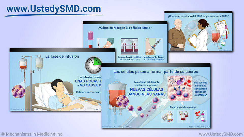 Presentación de diapositivas - Trasplante de sangre y médula en SMD