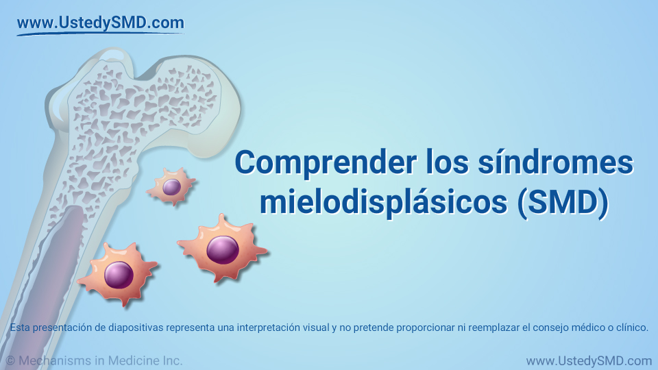 Comprender los síndromes mielodisplásicos (SMD)