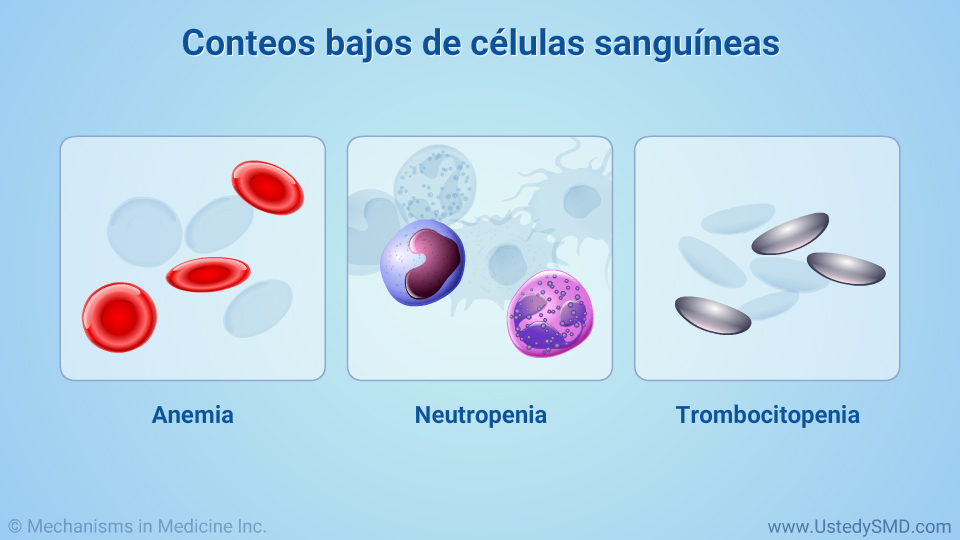 Conteos bajos de células sanguíneas