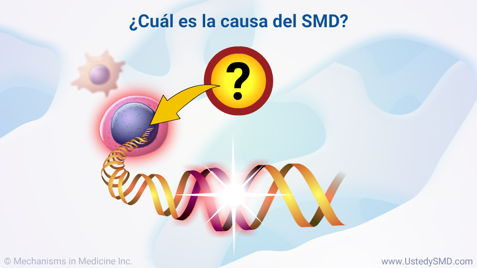 ¿Cuál es la causa del SMD?