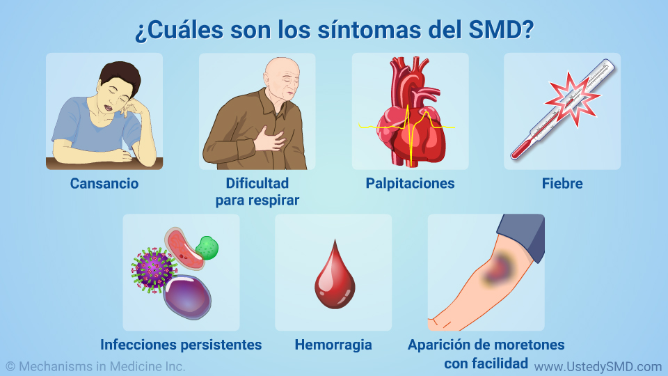 ¿Cuáles son los síntomas del SMD?