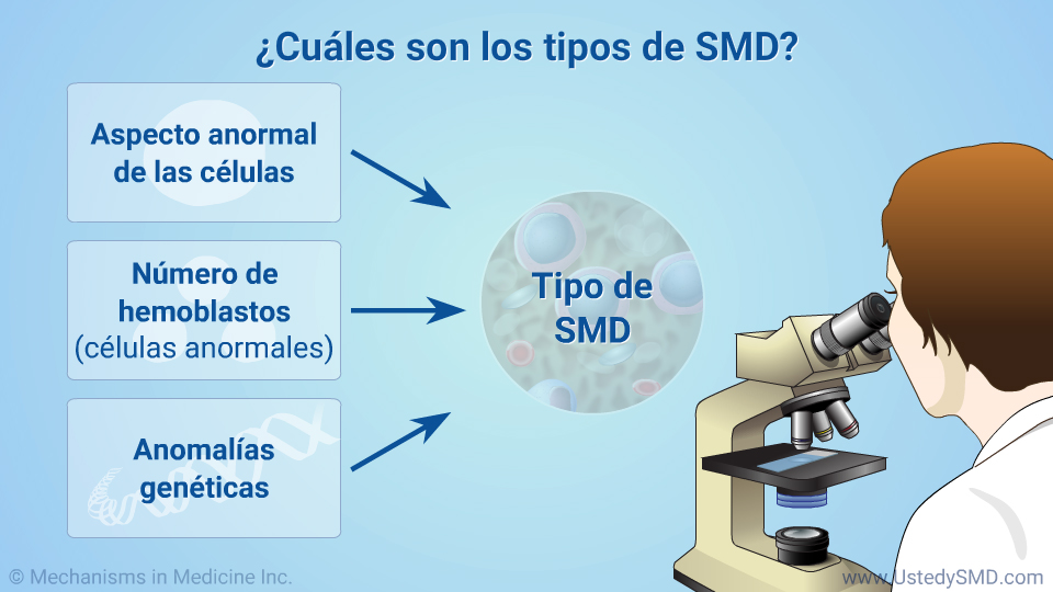 ¿Cuáles son los tipos de SMD?