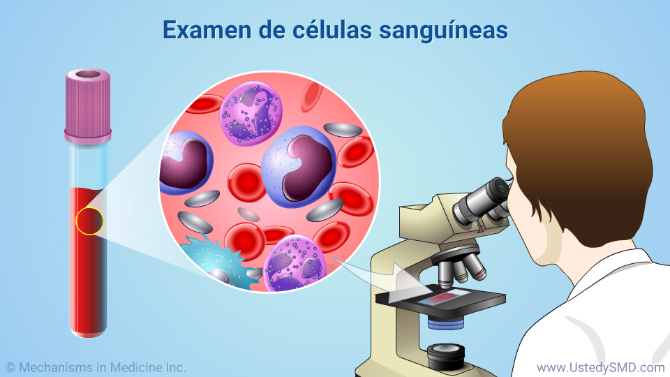 Examen de células sanguíneas