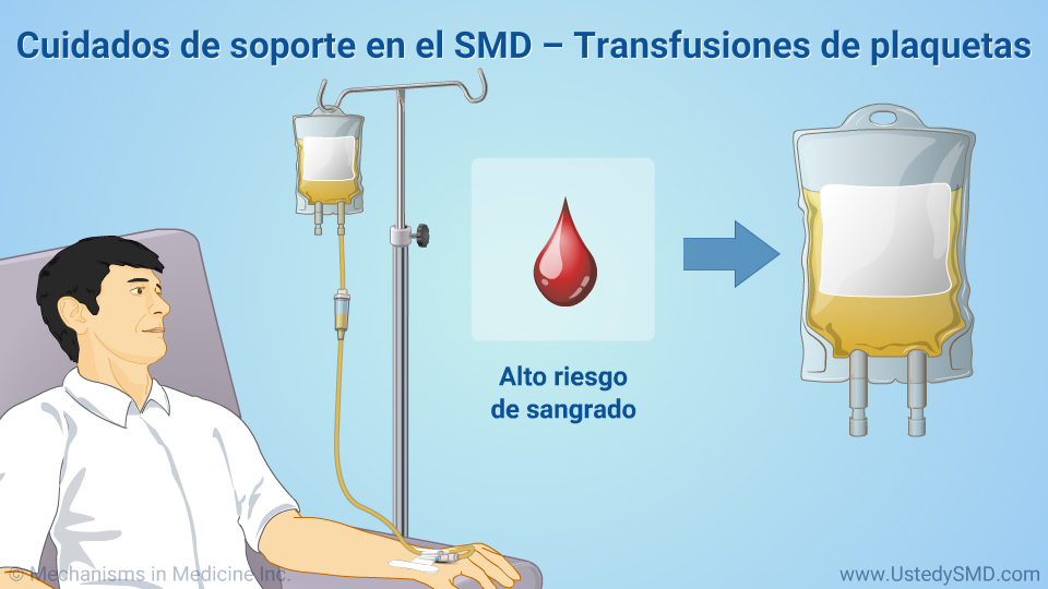 Cuidados de soporte en el SMD – Transfusiones de plaquetas