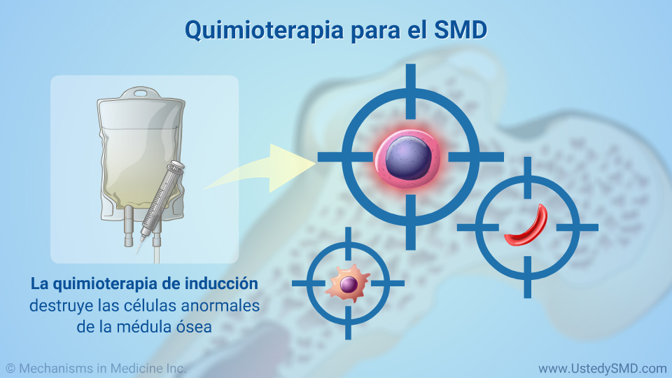 Quimioterapia para el SMD